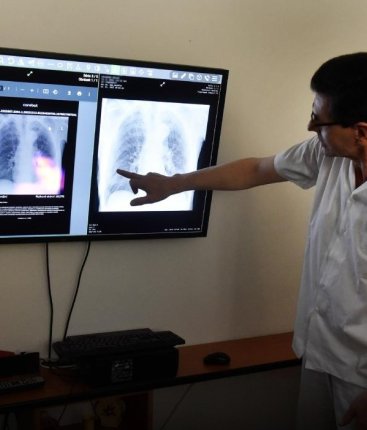 Nemocnice v Havířově testuje umělou inteligenci, která pomáhá číst rentgeny plic